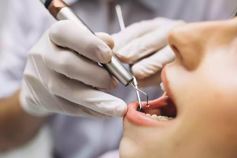 implantologia roma dentista implantologia roma dentista